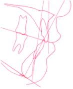 綺麗のヒミツEライン6