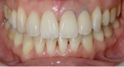 綺麗のヒミツEライン8