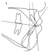 綺麗のヒミツEライン5