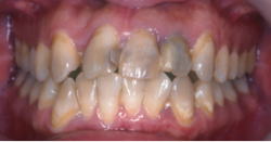 綺麗のヒミツEライン7