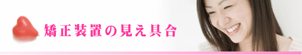 矯正装置の見え具合