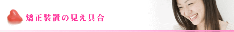 矯正装置の見え具合