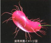 ポケット内洗浄4