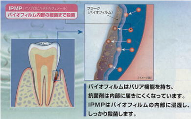 殺菌ペースト・プロケア2