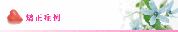 矯正症例