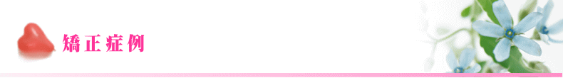 矯正症例